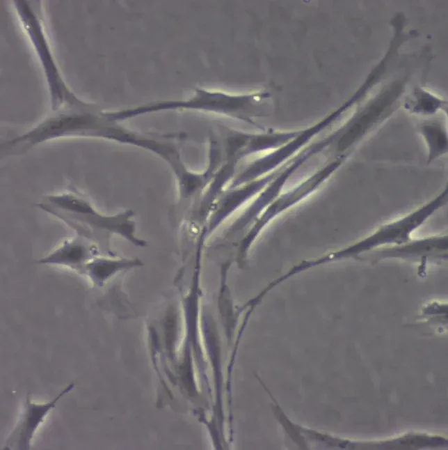 Stem Cell example provided from Gallant